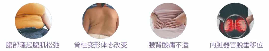 生完孩子就“分开”?!产后妈妈 你得这样“自救”(图5) 生完孩子就“分开”?!产后妈妈 你得这样“自救”(图5)
