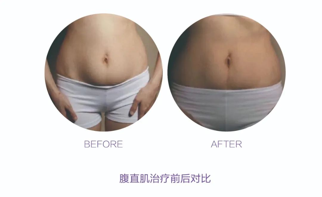 生完孩子就“分开”？！产后妈妈 你得这样“自救”(图7)