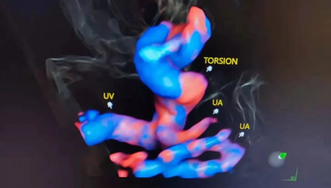 没想到你是这样的“超人”!(图5) 没想到你是这样的“超人”!(图5)